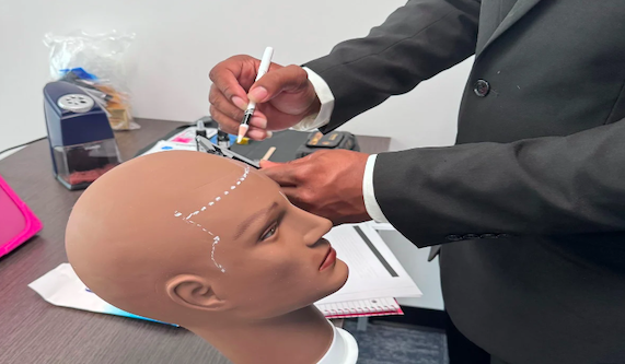 Scalp Micropigmentation