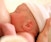 Lactation & Newborn Care Fundamentals